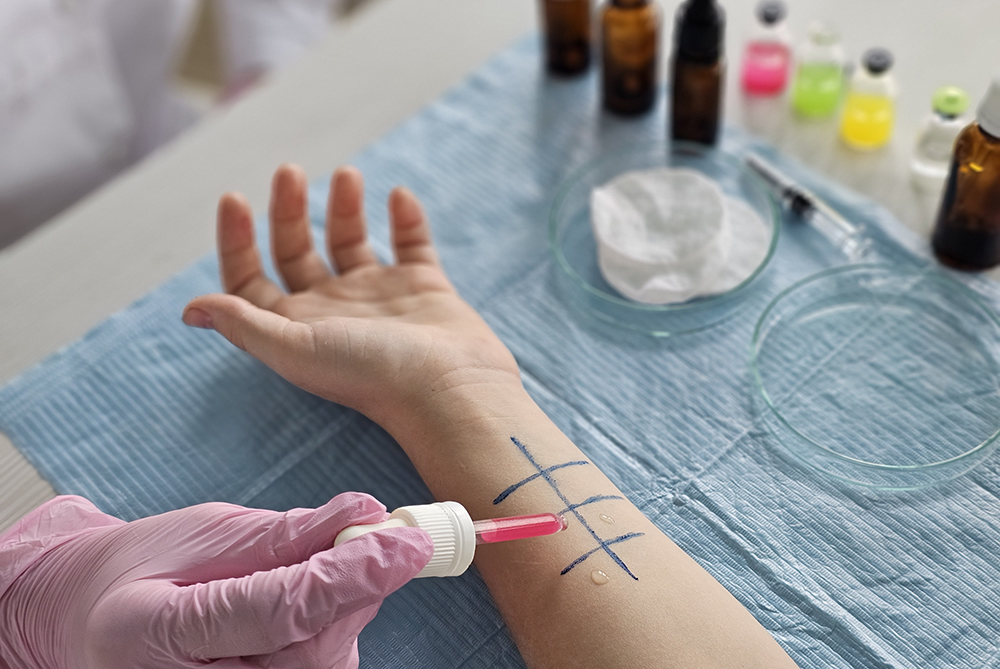 Allergy testing