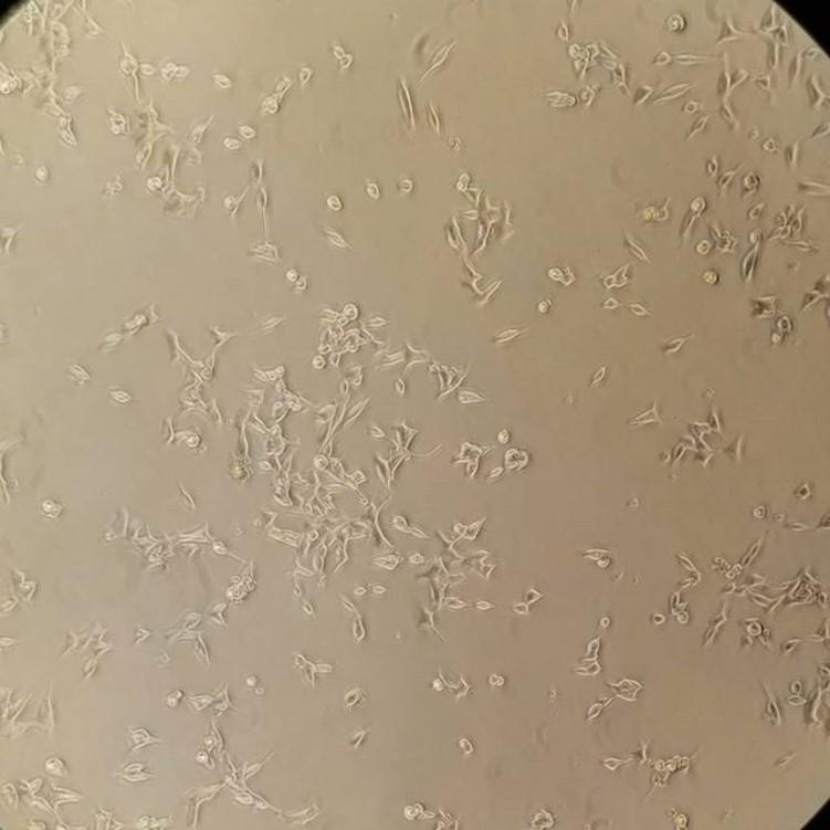 Photo of prostate cancer cell line (C4-2-B) on which Jessica worked
