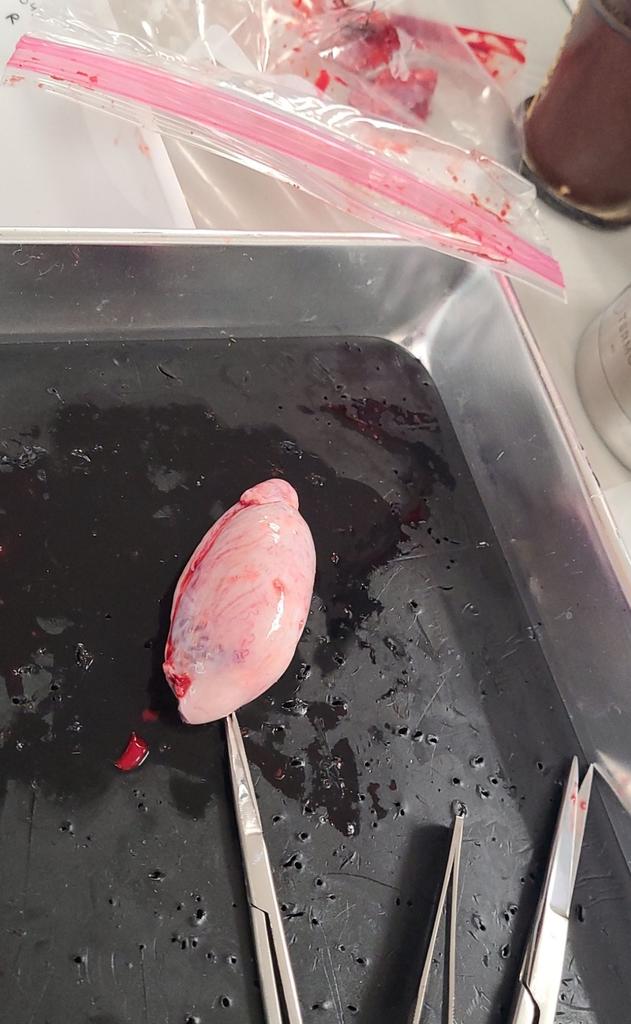 Testis that has been surgically removed